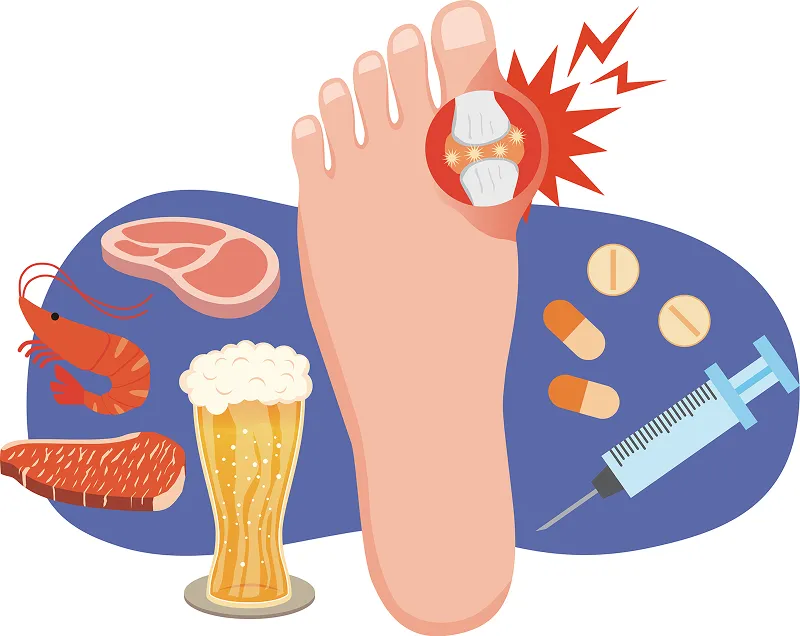 高尿酸血症で見られる合併症